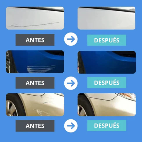 🏎️QUITA RAYONES - ULTIMAS UNIDADES🚗